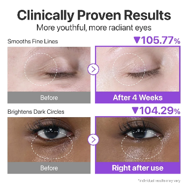 numbuzin

No.9 NAD+ Retinol Volumetox Eye Cream [10ml] (ojos)